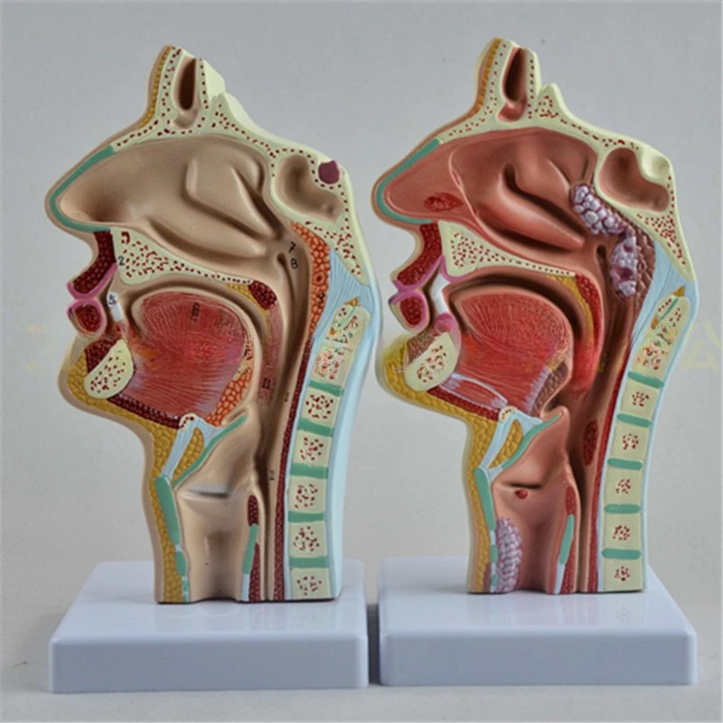 Модель анатомии носа человека патология отоларингология модель человеческой