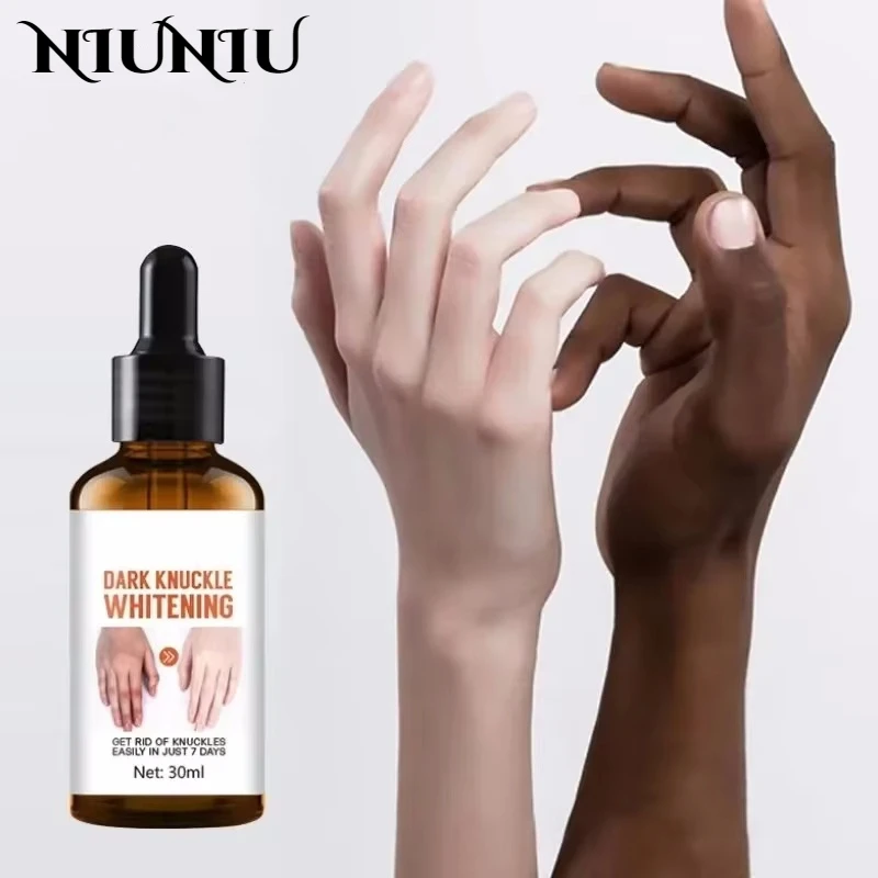 Осветляет кожу частных частей подмышек локтей осветляет меланин крем для рук