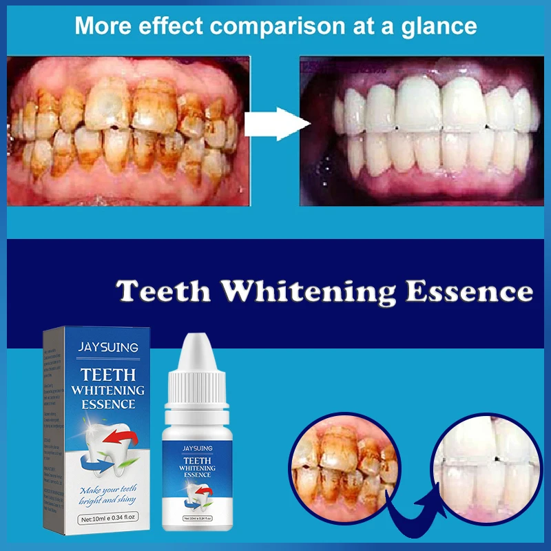Jemeesen Teeth Whitening Serum Removes Stains Plaque Whitens Teeth Maintains Dental Hygiene Cleans Removes Mouth Odor