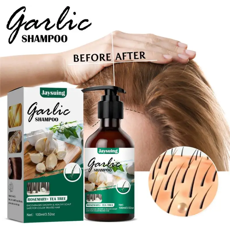 

Garlic Shampoo Hair Cleansing Anti Dandruff Anti-Itching Prevent Hair Loss Fast Regrowth Nourishing Scalp Shampoos Hair Care