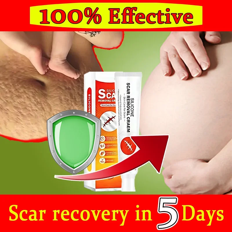 Удаляет растяжение удаляет после родов ожирение восстанавливает омоложение и