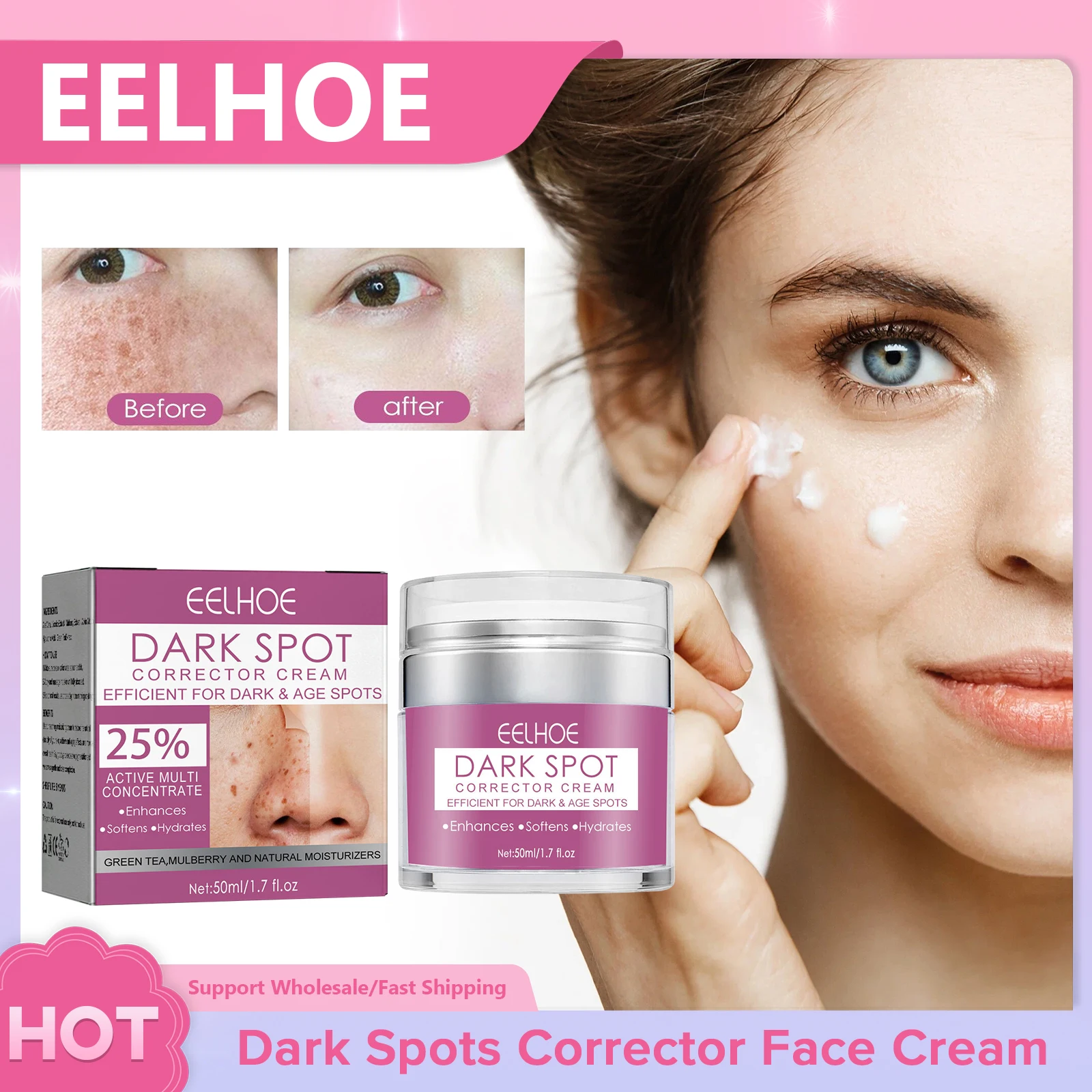 

Whitening Freckle Cream Remove Melanin Melasma Dark Spots Effective Fade Pigmentation Moisturizing Firming Facial Brighten Cream