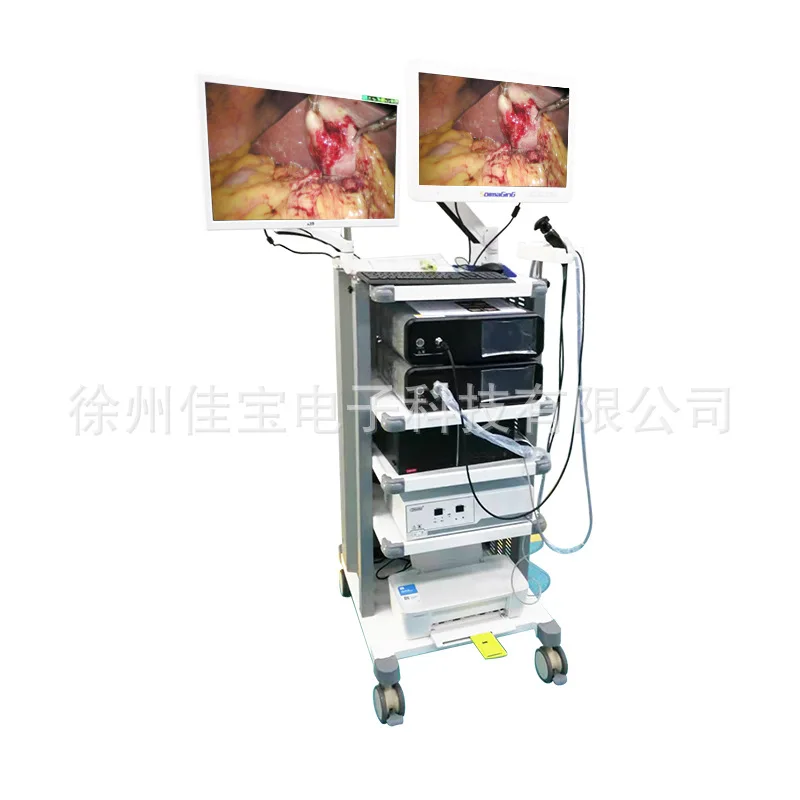 Рисунок 5 - Гинекологический осмотр Suoying FHD1080P