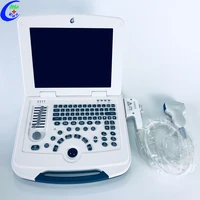 medical portable digital b mode laptop echo ultrasound scanner