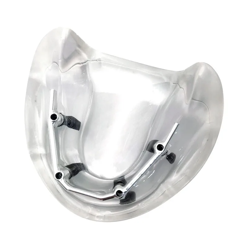 Зубной имплантат модель зубов 4 имплантаты зубной протез серебряный стержень