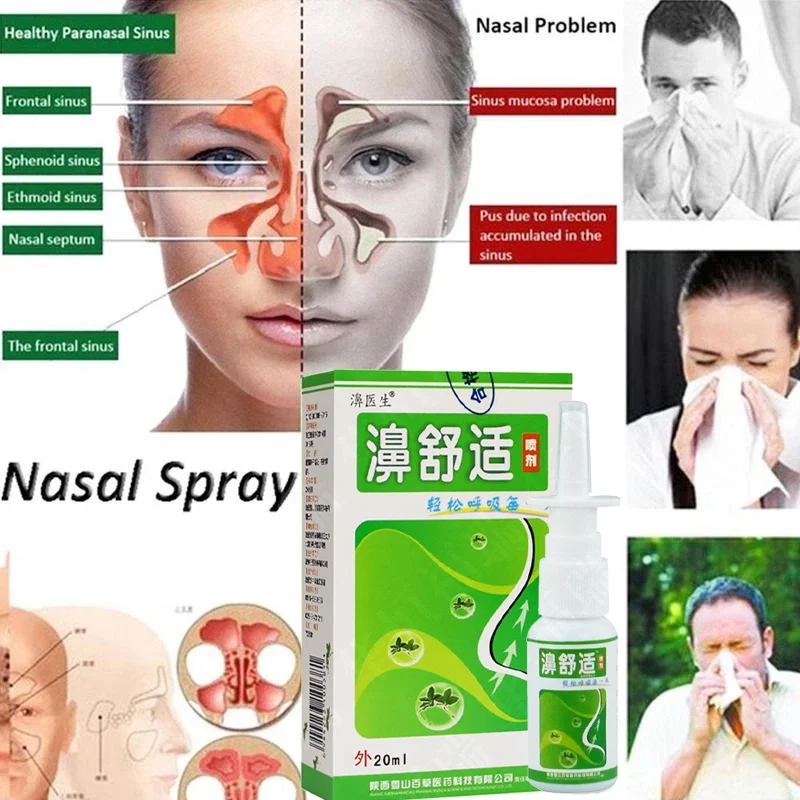 

20ml Rhinitis Spray Nasal Nose Care Chronic Rhinitis Treatment Nose Spray Chinese Traditional Medical Herb Nose care