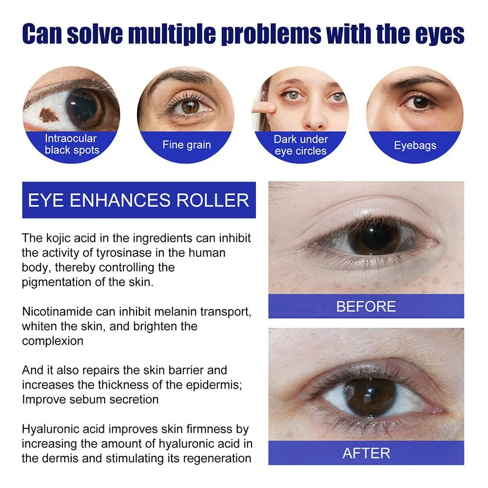 Рисунок 5 - Ролик для улучшения кожи вокруг глаз