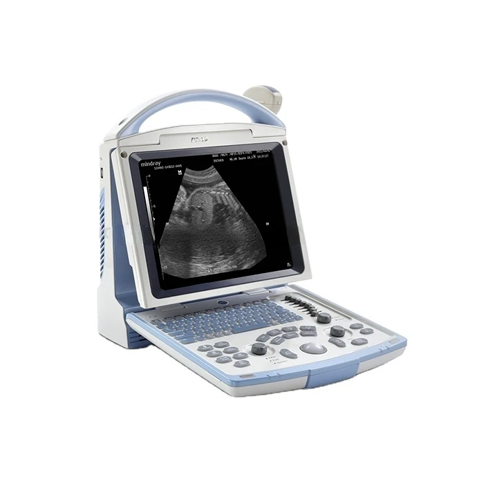 

mindray DP-10 ecografa portable ultrasound machine