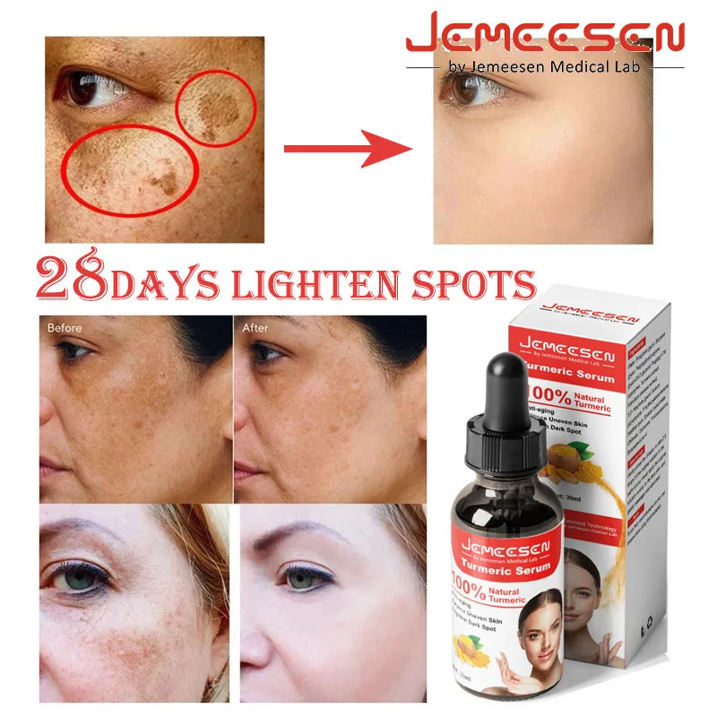 

Jemeesen Turmeric Serum Remove Melasma Dark Spot Lightening Melanin Brightening Melasma Remover Moisturize Anti-aging Face Care