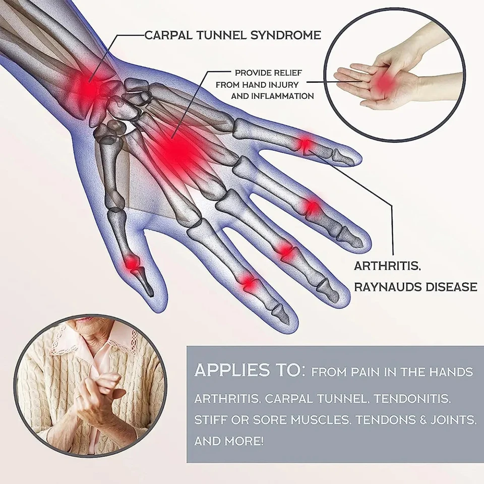 1 пара медных бриллиантов для облегчения боли в руках ревматоидного остеоартрита