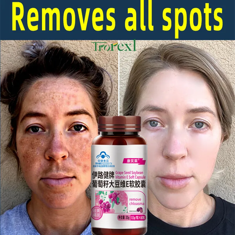 

60pcs Anti-Aging Remove Melasma Spot Skin Health Beauty Collagen Grape Seed Extract Capsules Antioxidant Supplement Vitamin E