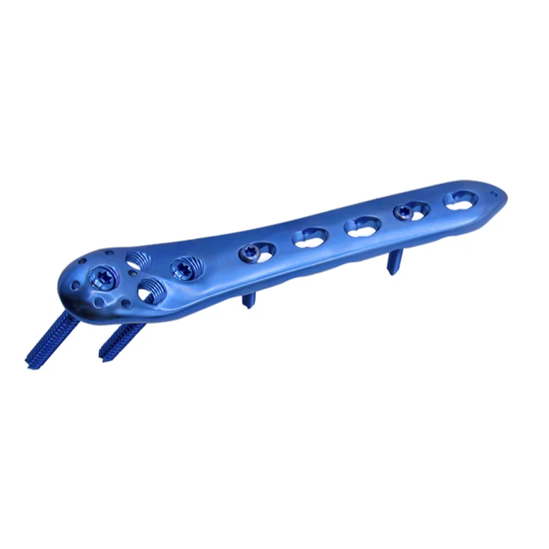 

Titanium Orthopedic Surgical Fixation Plate Price Proximal Femur Locking Plate For Bone Fracture