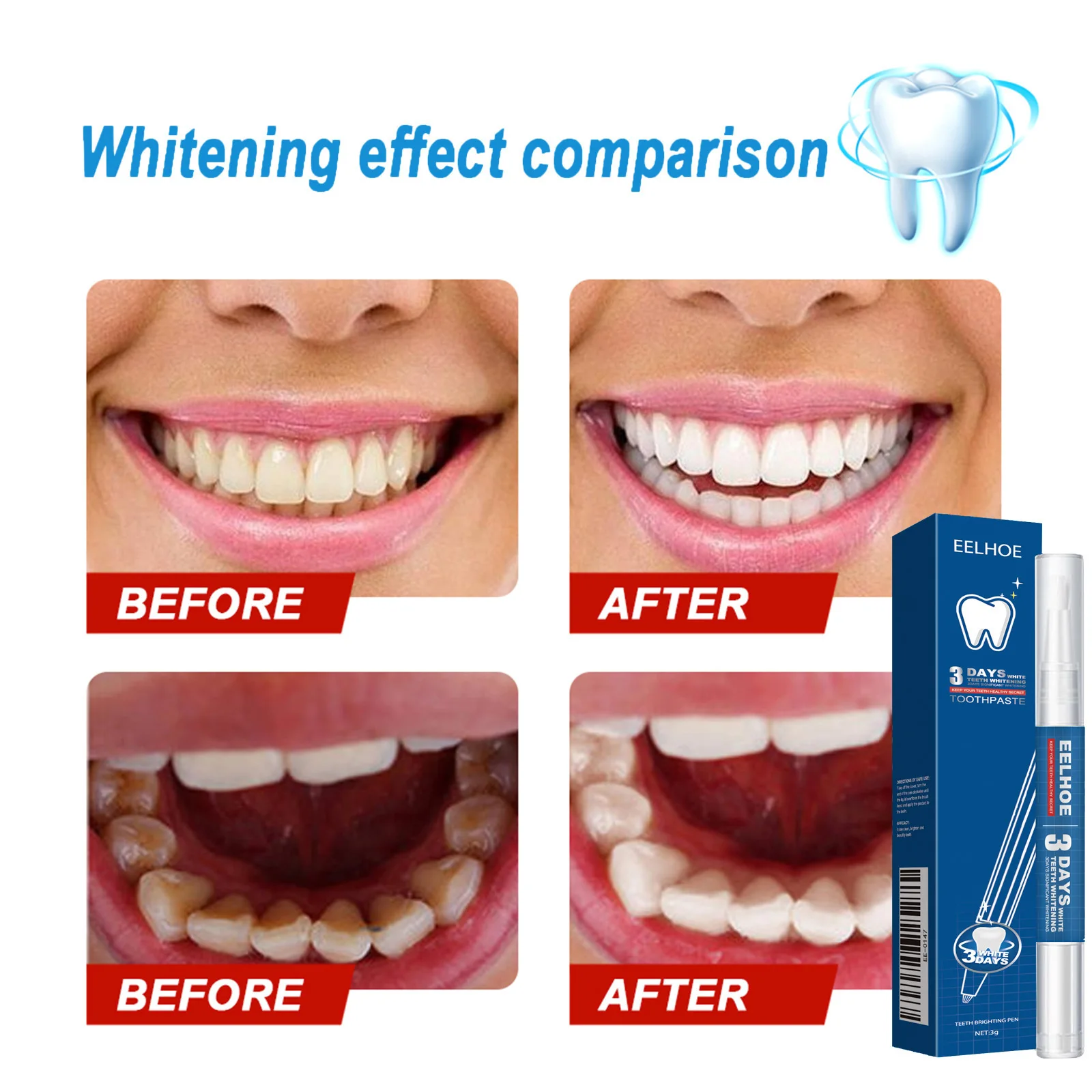 Ручка для отбеливания зубов гель гигиены полости рта чистящий отбеливающий