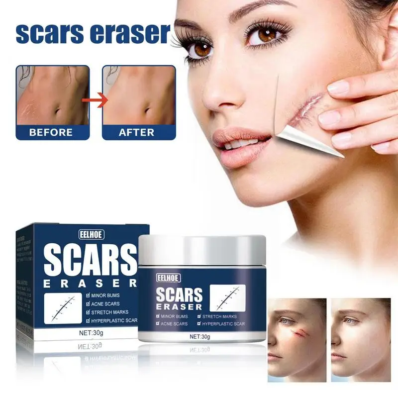 

Scar Fade Cream Stretch Marks Removal Pimple Scars Whitening Moisturizing Cream Skin Repair Dark Spot Ointment Facial Care