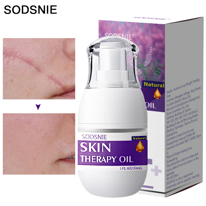 

Skin Therapy Oil Repair Deep Nourishment Remove Stretch Marks Lighten Scars Mild Not Irritating Anti-Wrinkle Massage Serum 30ml
