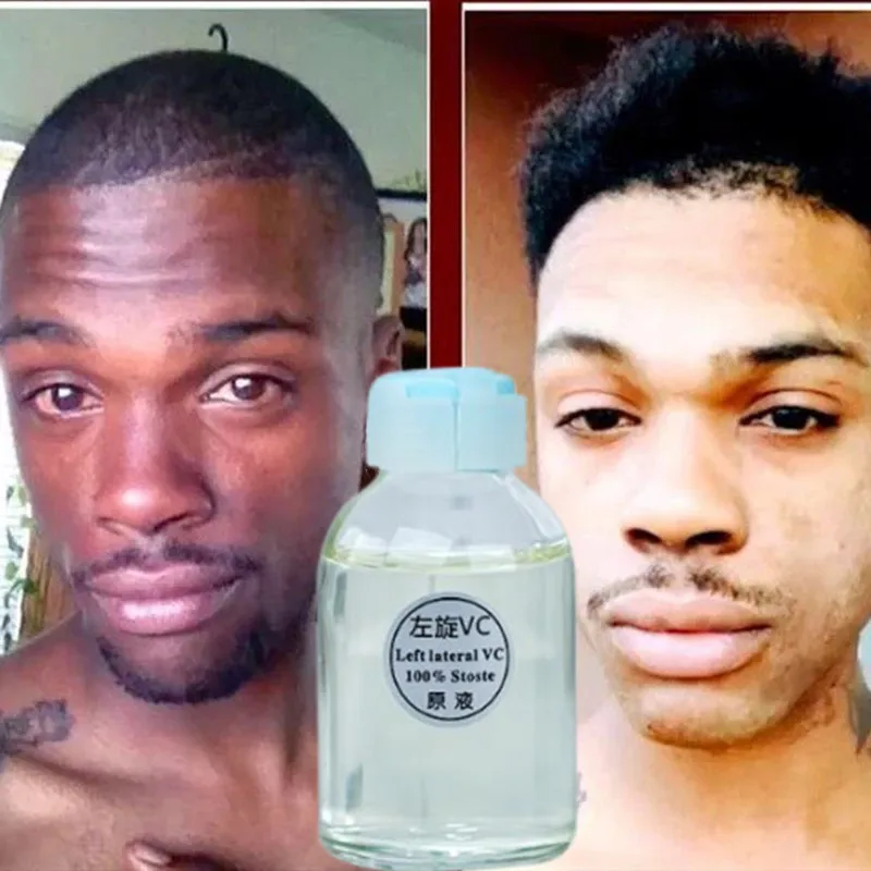 

Средство для отбеливания кожи с койевой кислотой, 30 мл