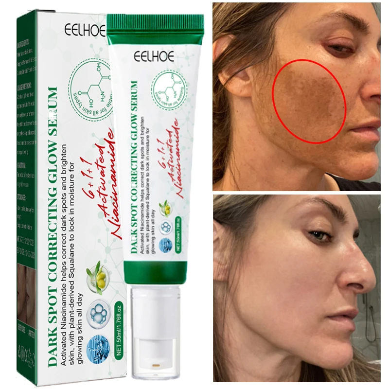 Nicotinamide Whitening Freckles Serum Remove Dark Spots Fade Melanin Pigmentation Moisturizing Brighten Anti-aging Face Beauty