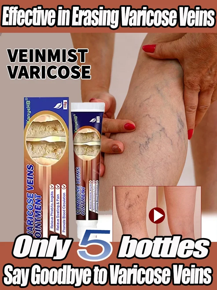 Мазь от варикозного расширения вен премиум-класса