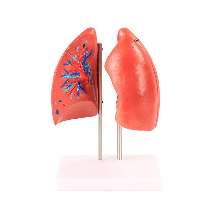 

BIX-A1073 Disassembled Human Lung Anatomical Model Medical Teaching Tool