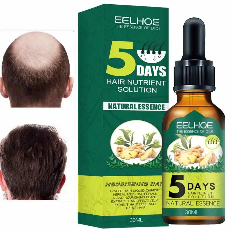 

Эфирное масло для ухода за волосами, эфирное масло для роста волос, эссенция для волос, масло для роста волос, питательное жидкое масло для выпадения волос, имбирное масло, 30 мл