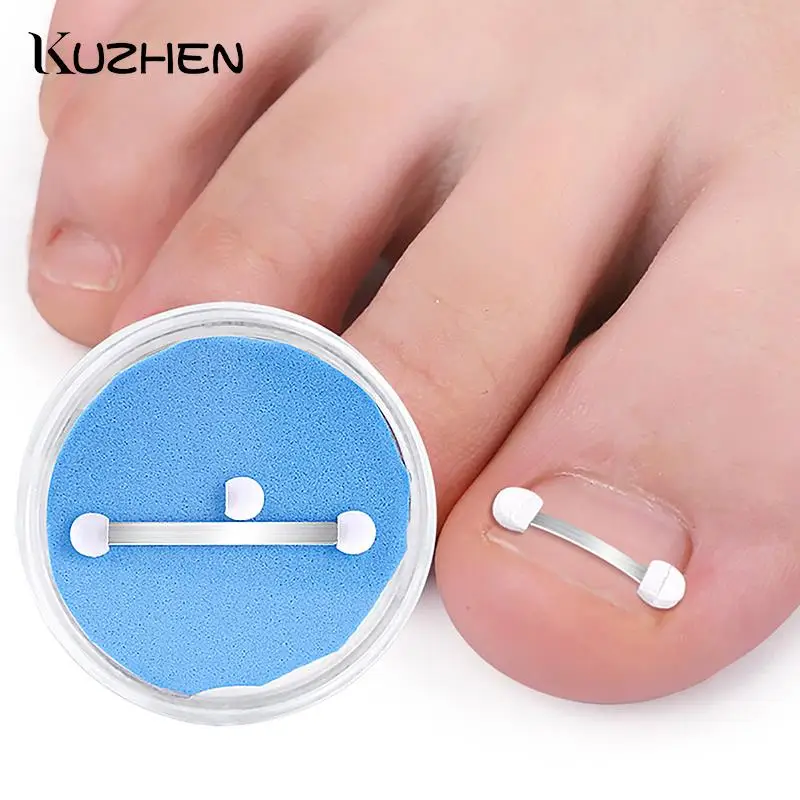 

Professional Ingrown Toenail Correction Foot Care Tool Ingrown Toenail Corrector Tools Pedicure Recover Embed Toe Nail Treatment