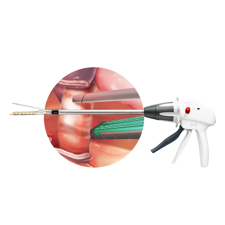 

Zoustech Endo GST60W Echelon 60 Stapler Reload for Colorectal Surgery