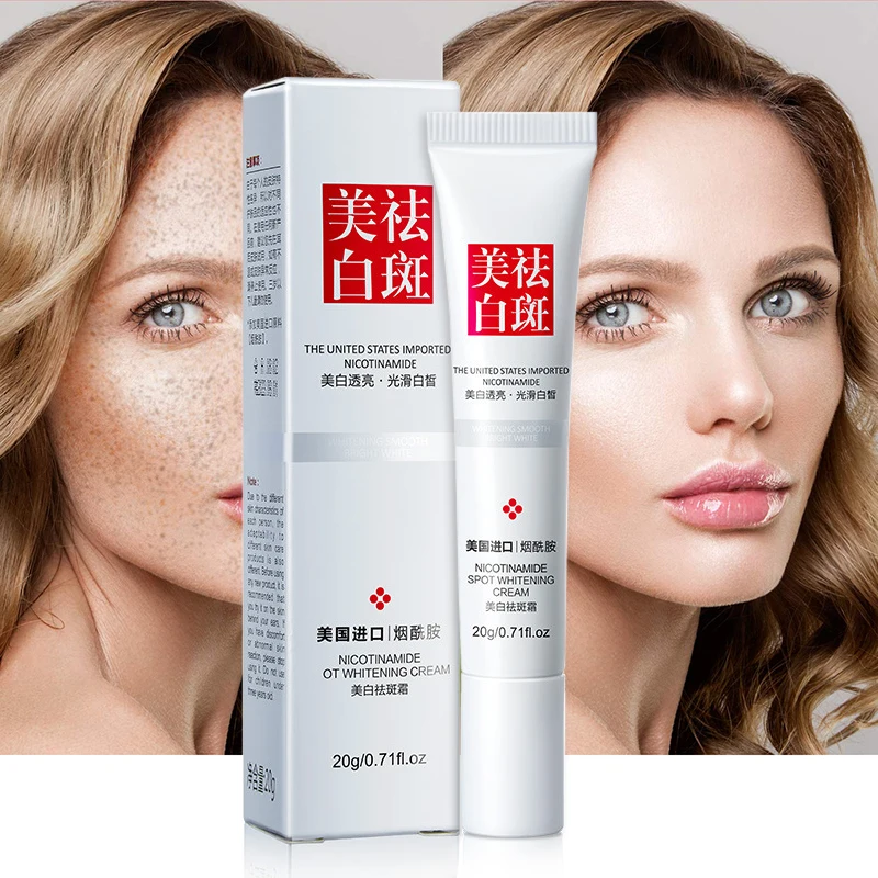 

20g Whitening Freckle Cream Remove Melasma Acne Spot Pigment Melanin Dark Spots Freckle Removal Cream Moisturizing Gel