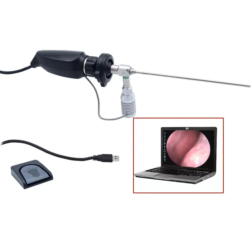 

Portable Flexible Endoscope Fiber Optic Video Bronchoscope For Anesthesia Intubation Operation