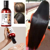 250ml hair care ginger anti hair loss hair essence shampoo effective hair loss treatment cool hair growth liquid