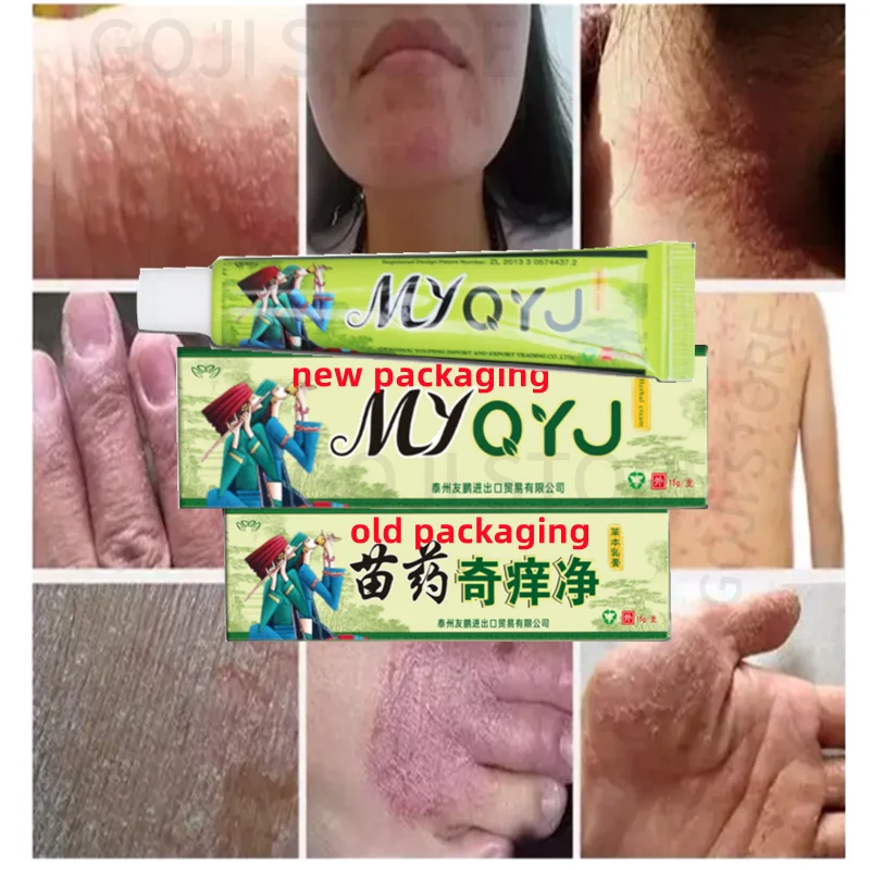 

20pcs New Body Health Psoriasis Dermatitis Eczema Pruritus Psoriasis Ointment China Creams Ointment Facial Cleansing