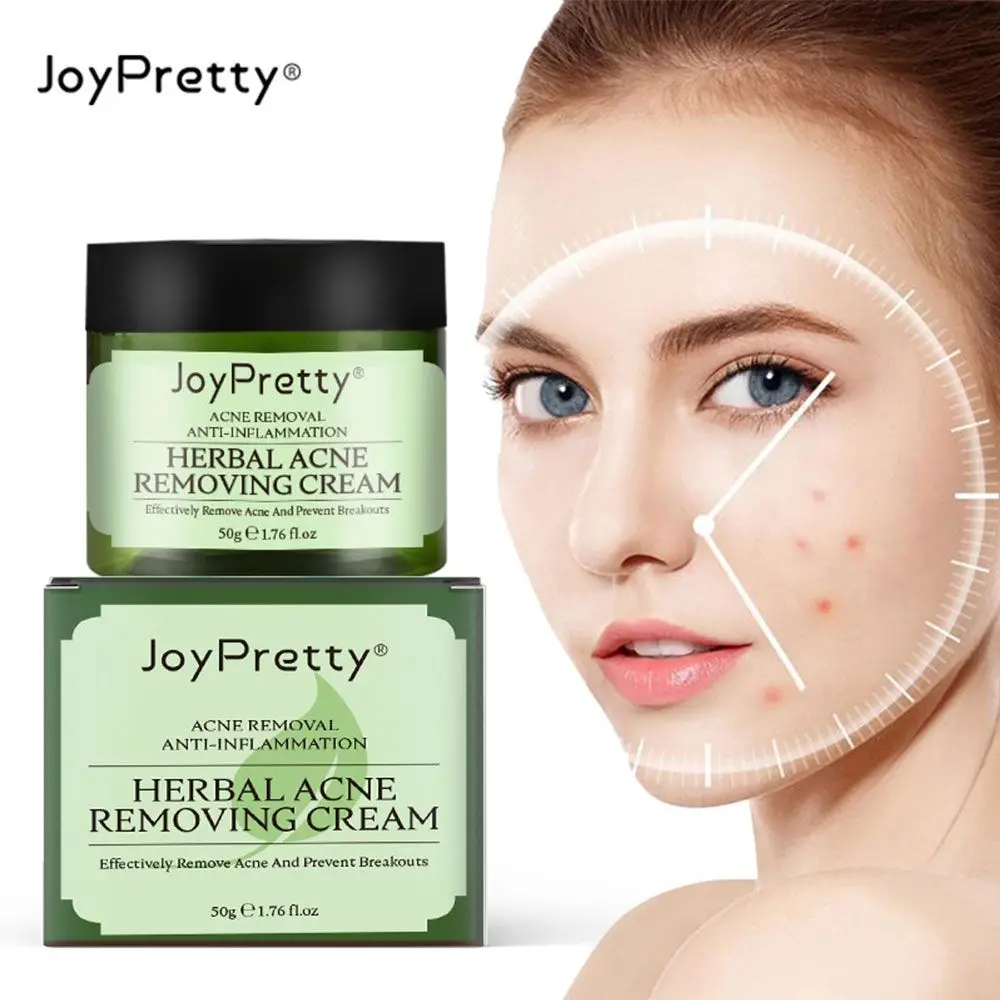 

JoyPretty Herbal Face Cream For Acne Skin Care Face Moisturizer Oil Control Pimple Acne Scar Removal Cream For Women Cosmetic