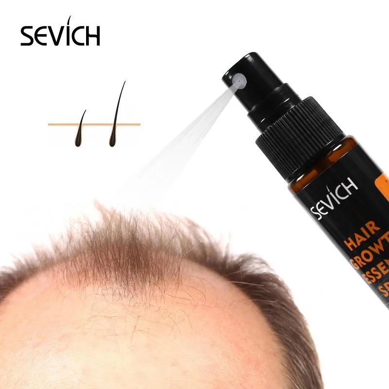 

Sevich Fast Growth Hair Spray Effective Treatment Of Hair Loss Nourishes The Scalp Help for hair Growth