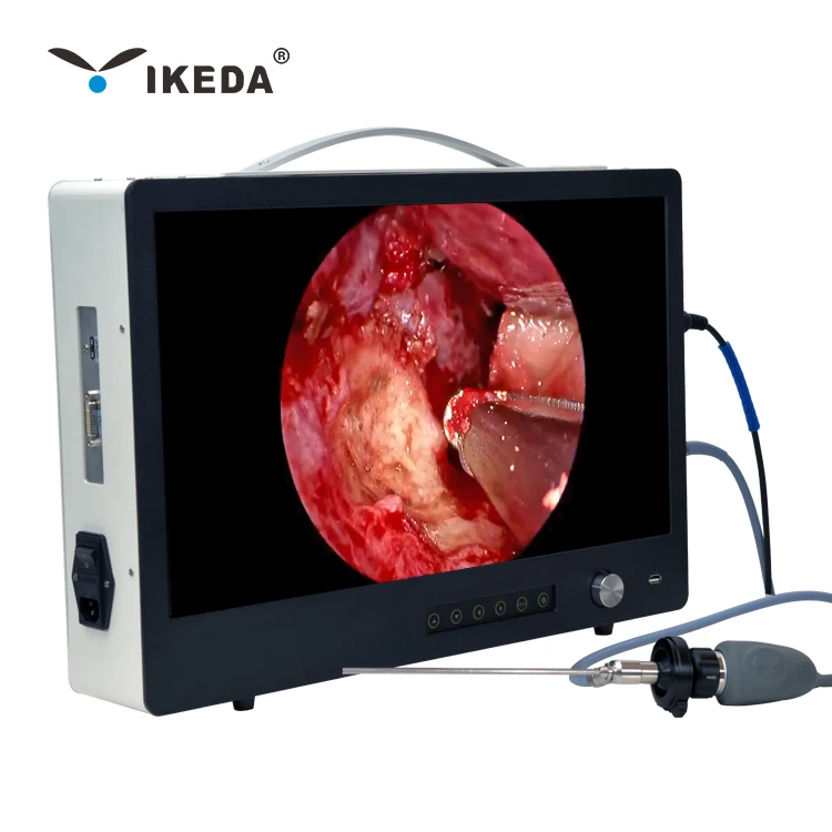 

Factory price medical 22 inch portable full HD endoscope camera system