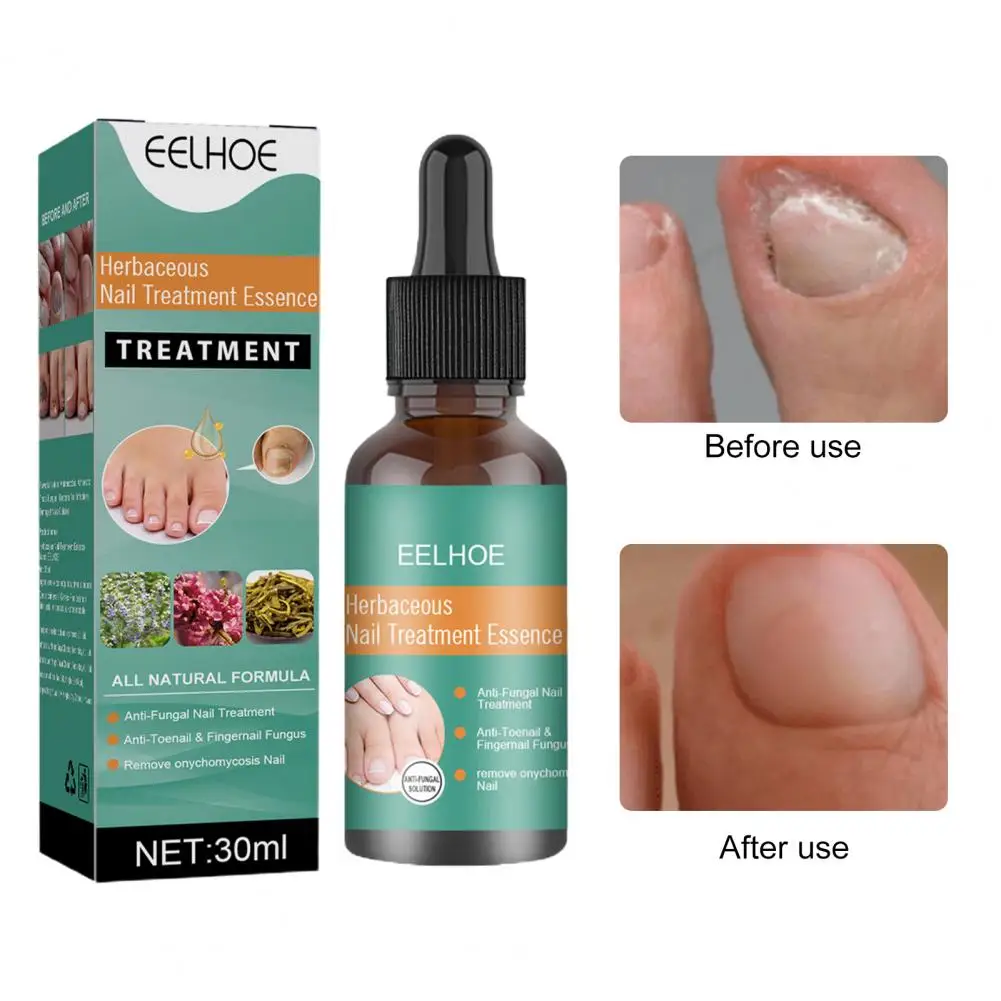 

Жидкость для лечения Ногтей, 30 мл