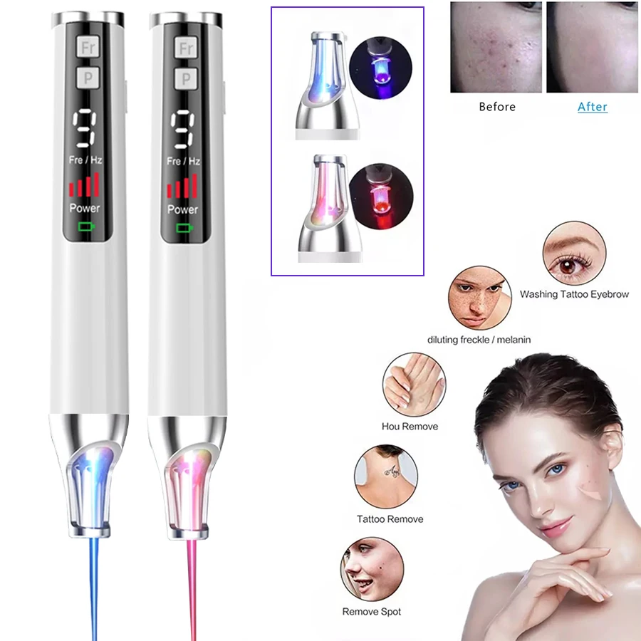 

New Laser Picosecond Pen Freckle Tattoo Removal Laser Mole Dark Spot Eyebrow Pigment Remover Acne Remove Beauty Care 9 Speeds