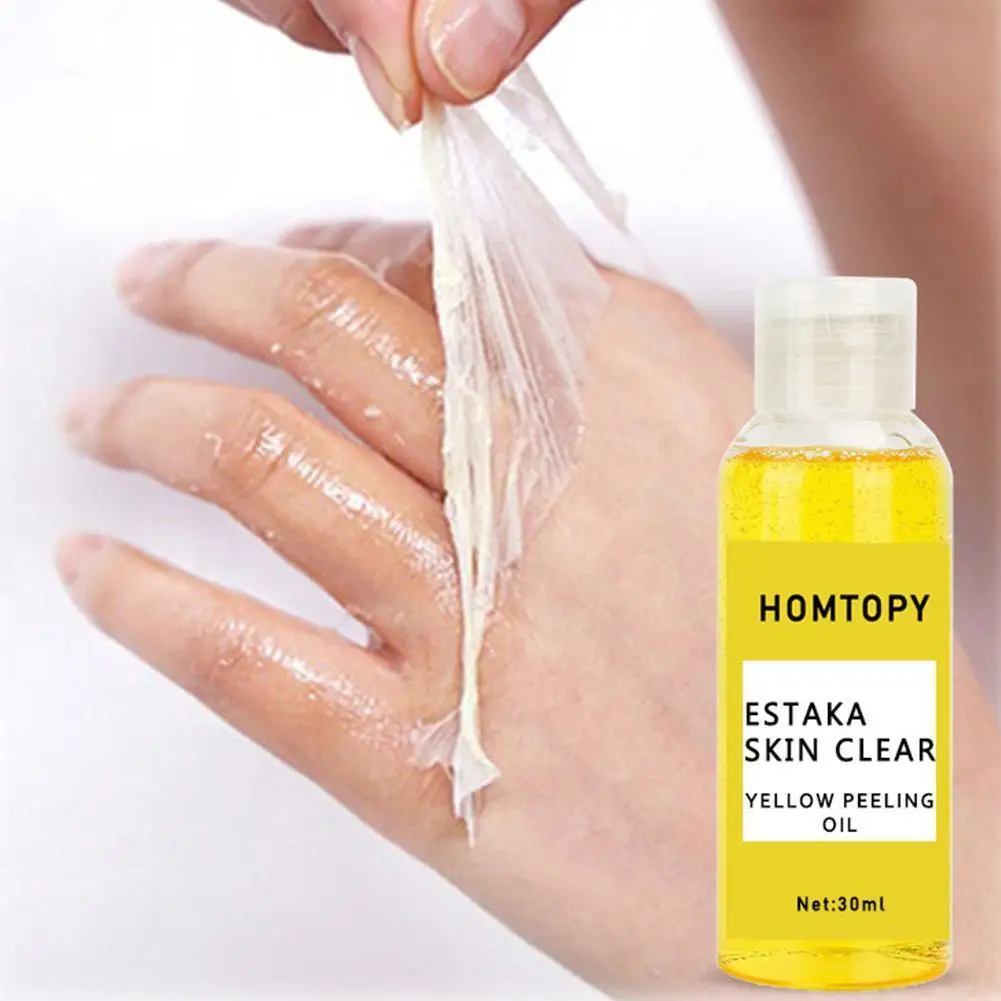 

Body Exfoliation Yellow Peeling Oil Bleaching Dark Brightening Knee Skin Legs Whitening Remove Care Arm Beauty Skin U8O9