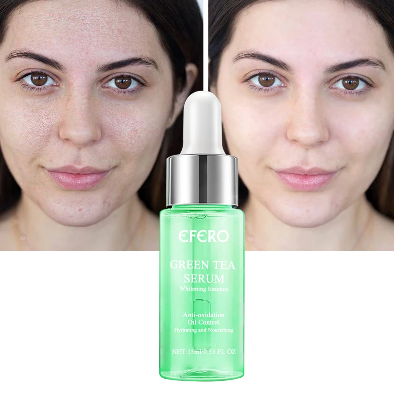 Увлажняющая отбеливающая Сыворотка для лица с гиалуроновой кислотой | Красота и