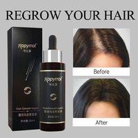 60ml hair growth essence dense hair growth serum for menwomen hair loss treatment scalp care ginger germinal regrowth hair oils