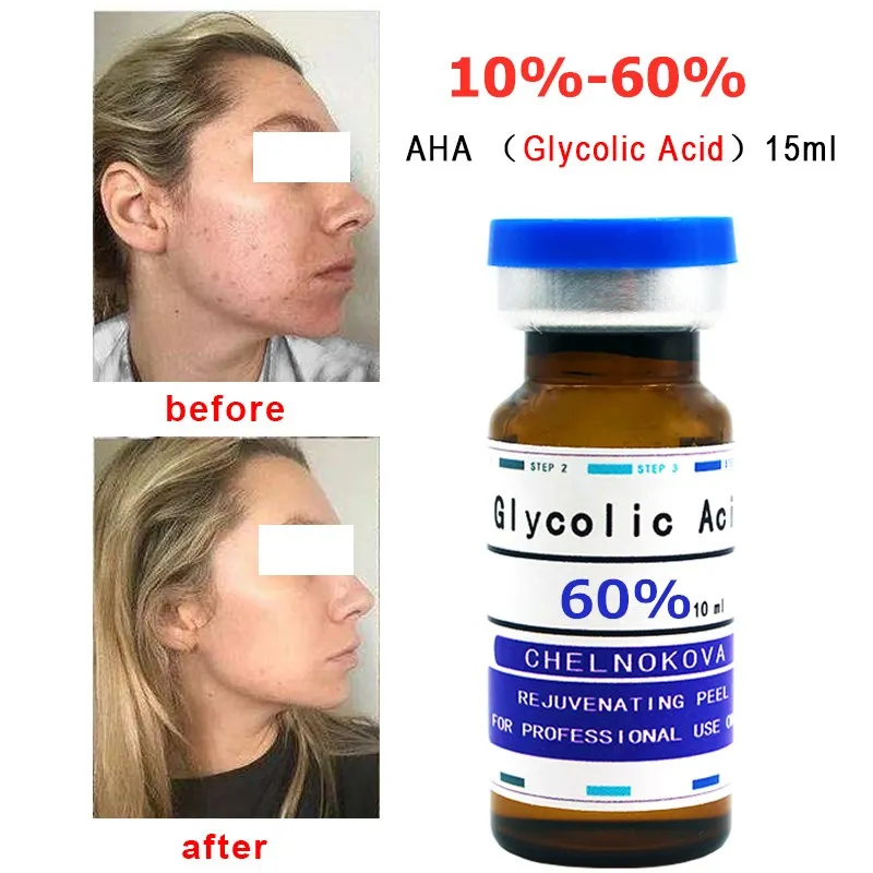 

70% Glycolic Acid Professional Grade Peel AHA Acne print chloasma black spots pregnancy marks exfoliation Skin rejuvenation15ML