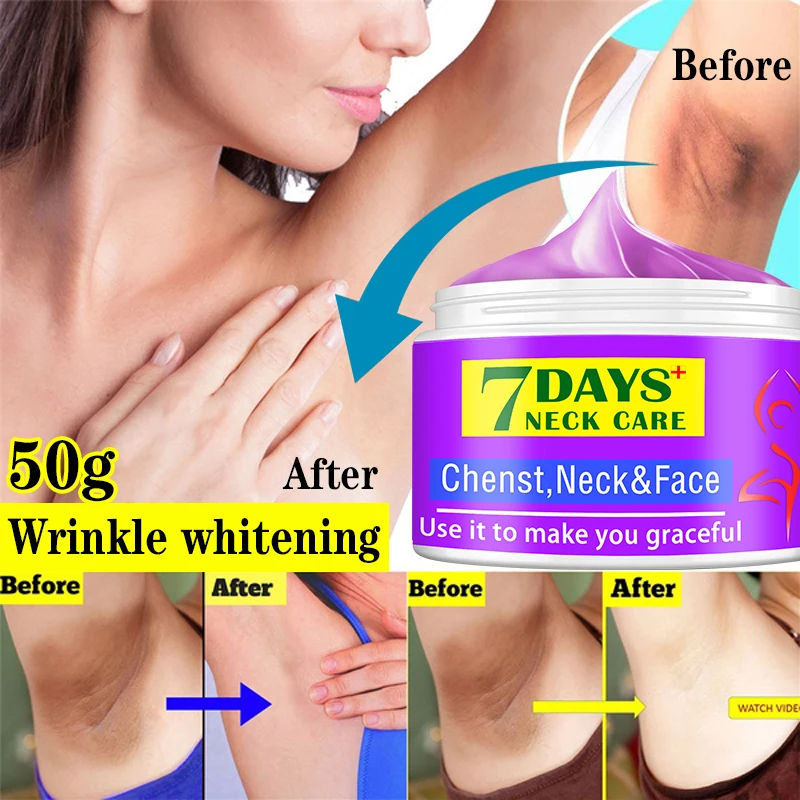 

7days Body Whitening Cream Underarm Armpit Knee Dark Spot Cream Skin Brighten Moisturizing Body Care Cosmetics for Women Men