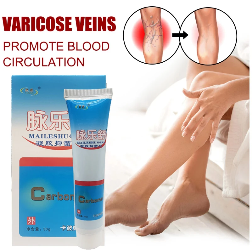 

30g Varicose Veins Ointment Legs Smoothing Redness Repair Dressing Effective Phlebitis Analgesics Spider Vein Pain Care Cream