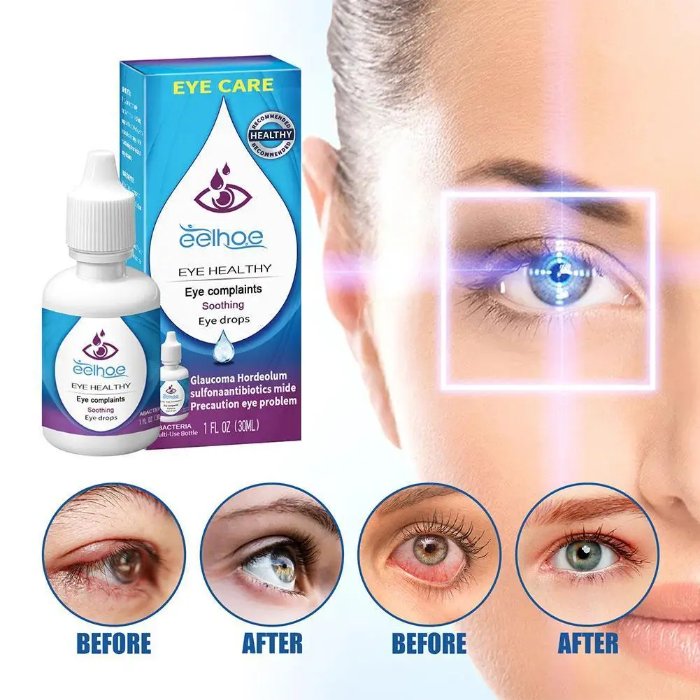 

30ml Eye Drops Eye Protection Relieve Fatigue Dry Treat Eyes Styes Eye Of Diseases Ointment Eye Red Prevention B3F3