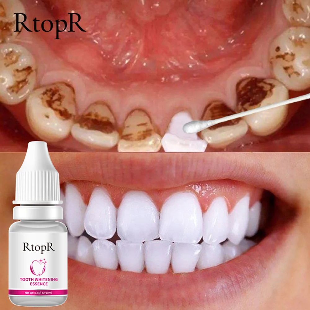RtopR Teeth Whitening Serum Remove Plaque Stains Bleachig Teeth Essence Oral Hygiene Cleaning Gel Fresh Breath Care Dental Tools