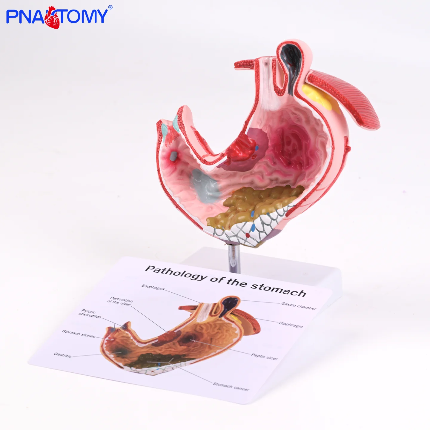 

Анатомическая модель желудка PNATOMY