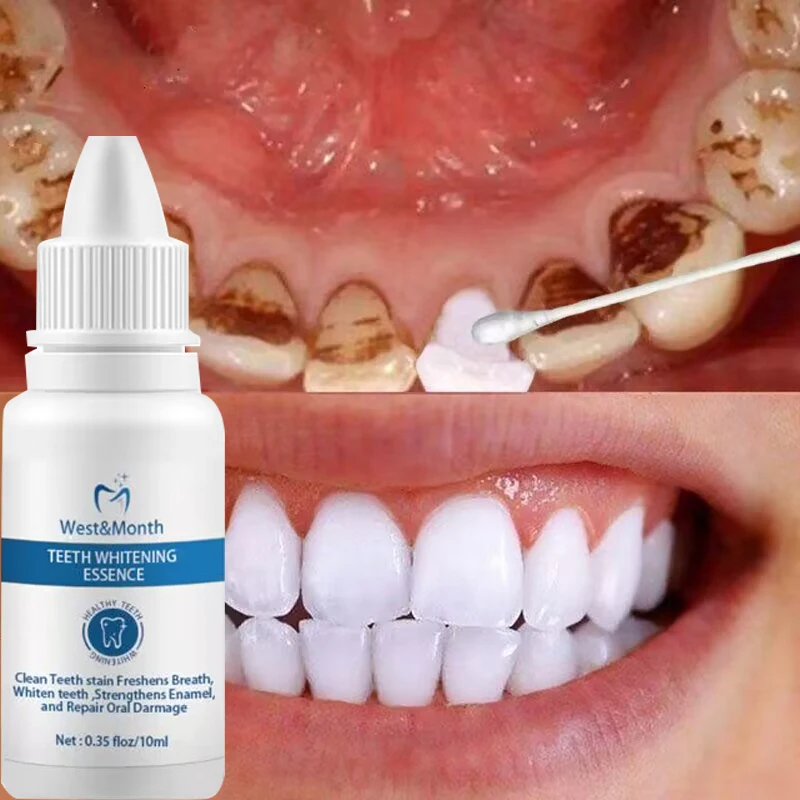 Teeth Whitening Essence Remove Smoke Coffee Plaque Stains Cleaning Oral Hygiene Gel Fresh Breath Bleaching Dental Products Tools