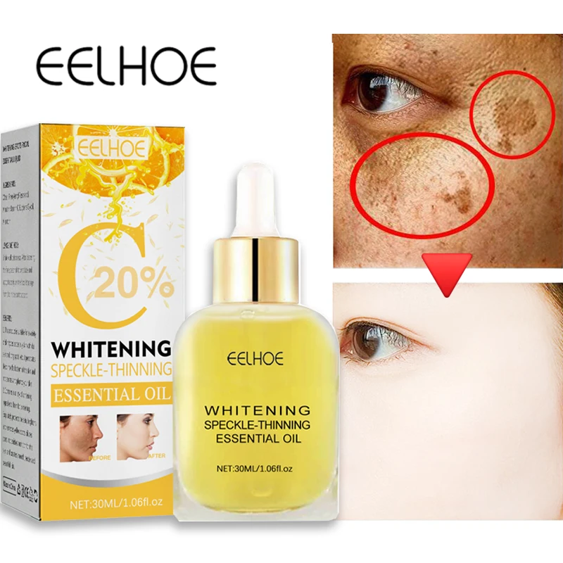

Spot Removal Black Spot Remover For Face Remove Age Spots Chloasma Freckles Sun Spots