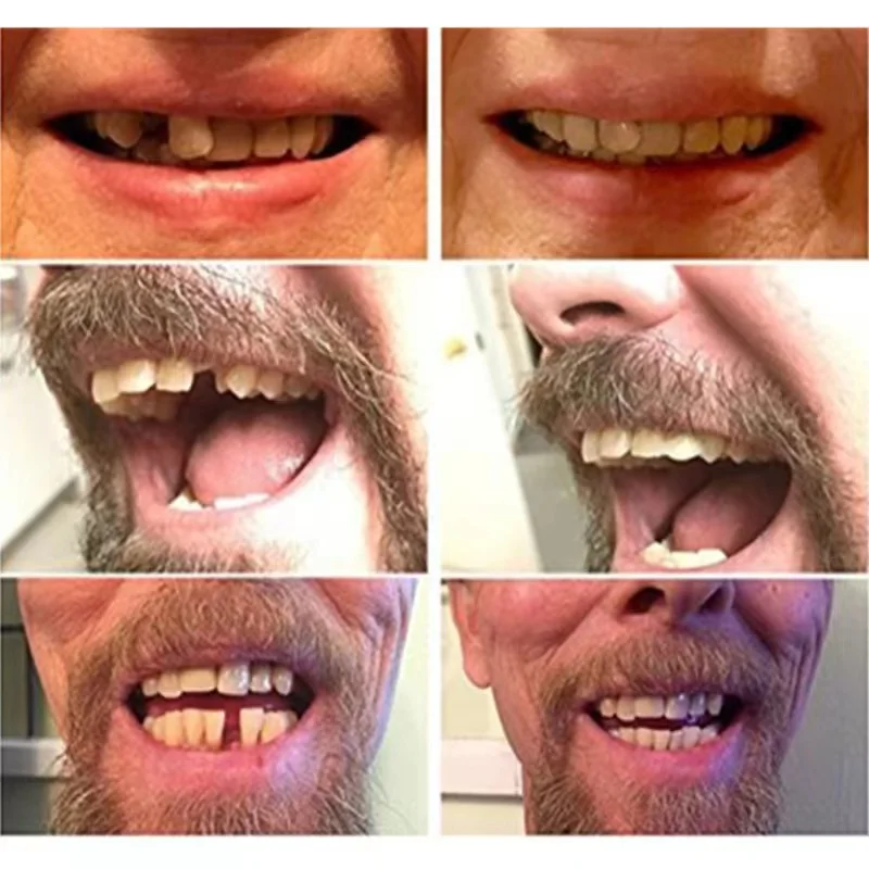Falseteeth прочные высококачественные накладные зубы виниры для красоты временные