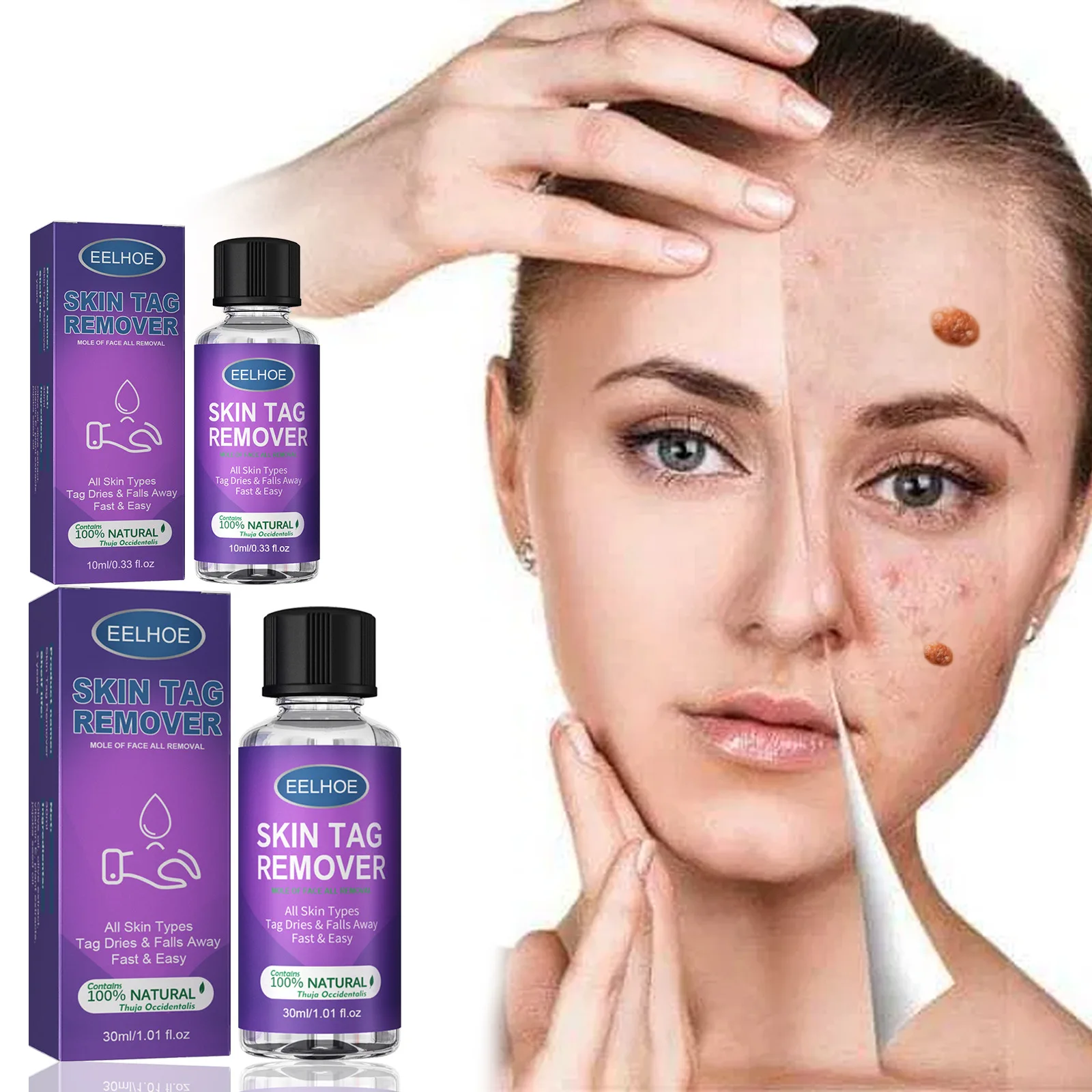 

Этикетки для удаления бородавок на коже, плоские бородавки, безболезненный крем на травах, мазь, бирки для удаления бородавок на коже, жидкий крем для лечения родинок