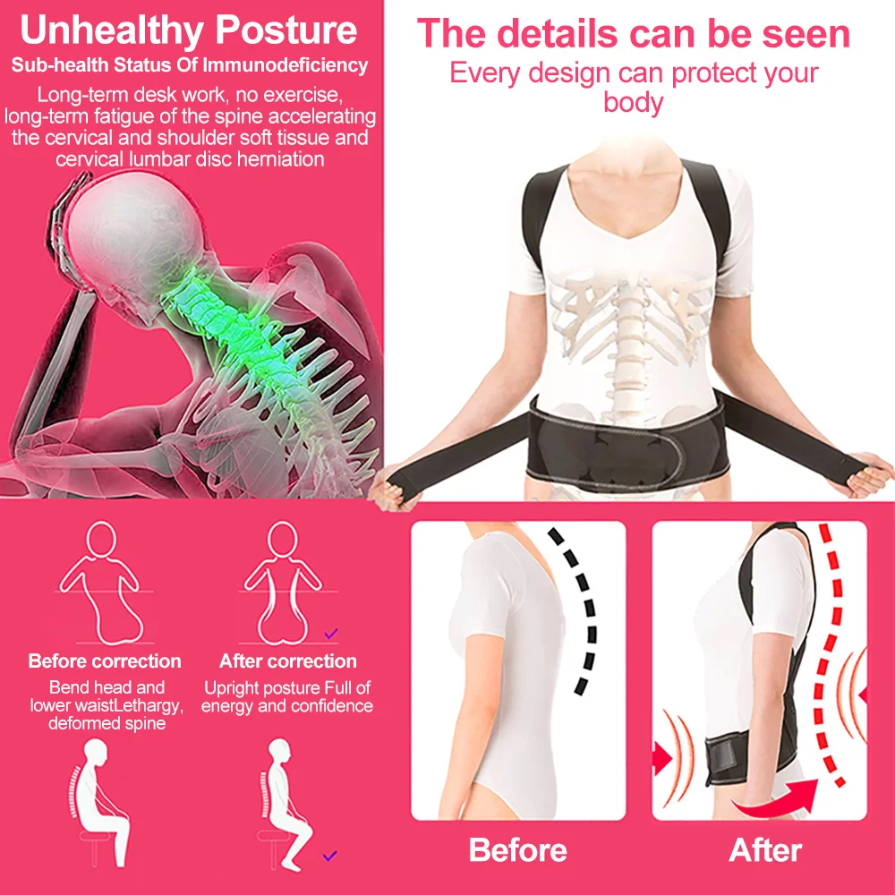 Back Posture Corrector Back Brace for Scoliosis Therapy Corset Spine Support Belt Lumbar Back Posture Back Brace with Bandage