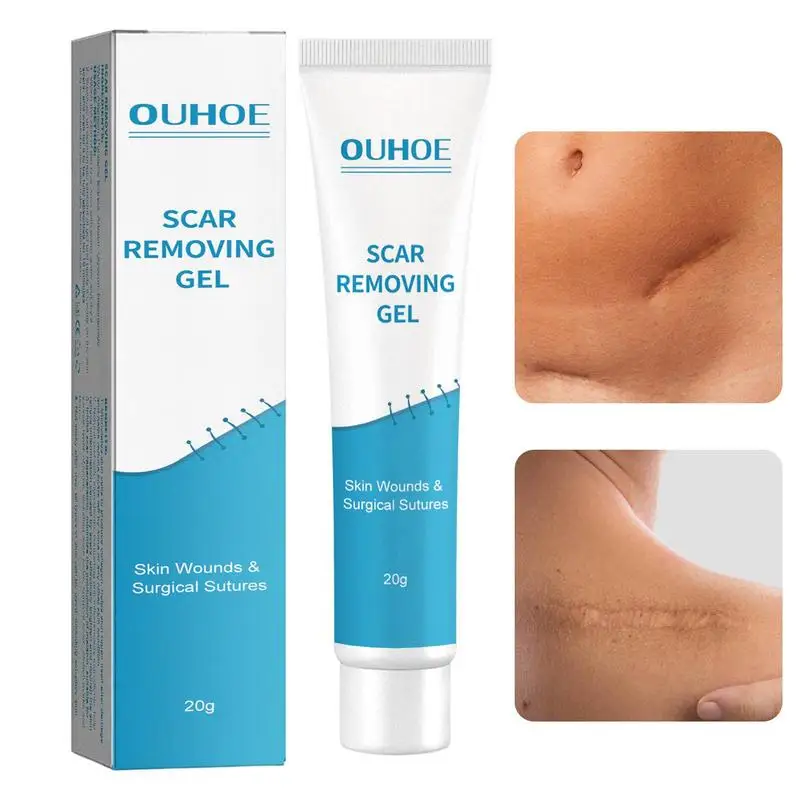 

20g Natural Scar Repairing Gel Non-Greasy Stretchmarks Lighten Cream Dry Skin Smoothing Moisturizer For All Skin Types Scar Gel